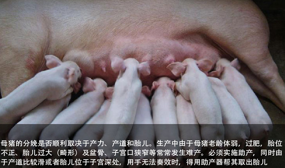 为什么需要助产钳